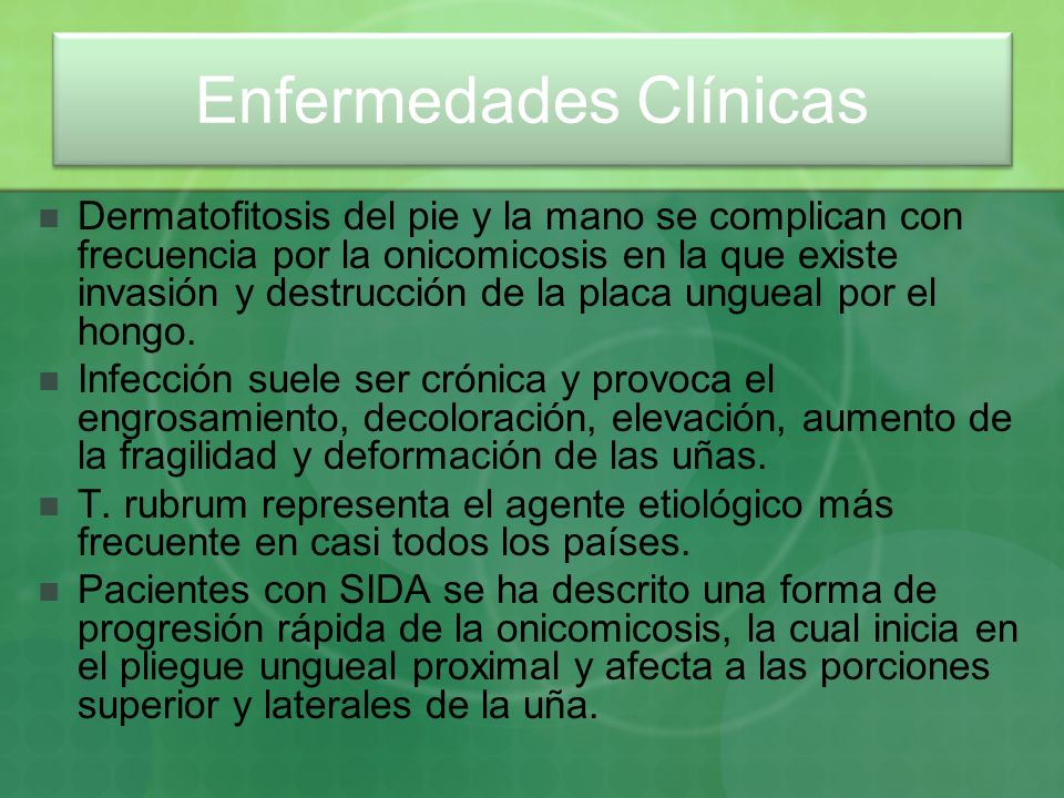 Como librarse del hongo de la uña por los métodos públicos